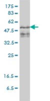 Western Blot: ZFYVE19 Antibody (4D5-2D11) [H00084936-M01]