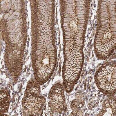 Immunohistochemistry: ZFYVE19 Antibody [NBP2-58993]