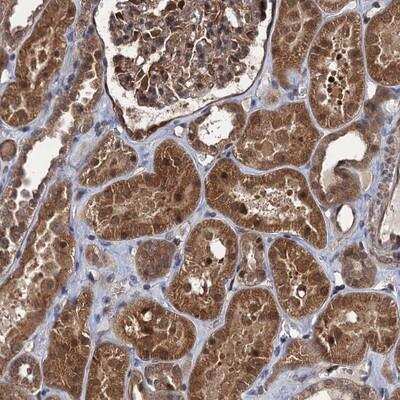 Immunohistochemistry-Paraffin: ZFYVE19 Antibody [NBP1-83679]