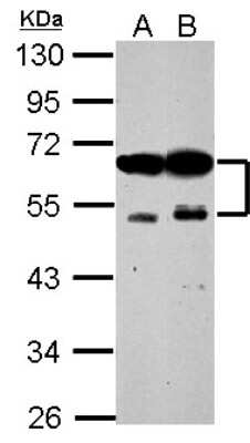 Western Blot: ZFYVE19 Antibody [NBP2-20951]