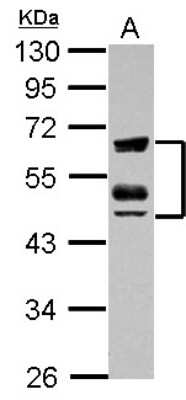 Western Blot: ZFYVE19 Antibody [NBP2-20952]