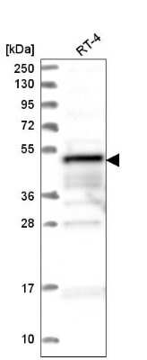 Western Blot: ZFYVE19 Antibody [NBP2-58993]