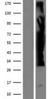 Western Blot: ZFYVE19 Overexpression Lysate [NBP2-08452]