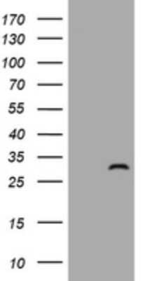 Western Blot: ZFYVE21 Antibody (OTI2B12) [NBP2-46407]