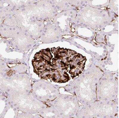 Immunohistochemistry: ZFYVE21 Antibody [NBP2-30498]