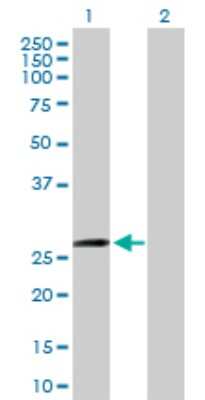 Western Blot: ZFYVE21 Antibody [H00079038-B01P]