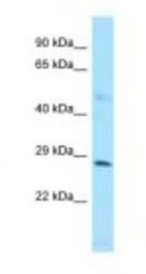 Western Blot: ZFYVE21 Antibody [NBP1-98434]