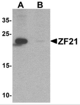 Western Blot: ZFYVE21 AntibodyBSA Free [NBP2-82050]