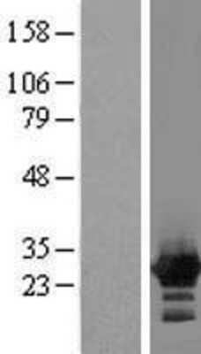 Western Blot: ZFYVE21 Overexpression Lysate [NBL1-18027]