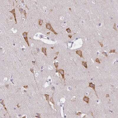 Immunohistochemistry: ZFYVE26 Antibody [NBP2-31606]