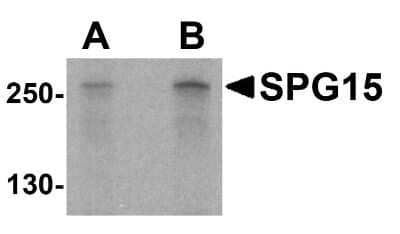 Western Blot: ZFYVE26 AntibodyBSA Free [NBP1-76331]