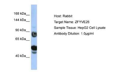 Western Blot: ZFYVE26 Antibody [NBP2-86424]