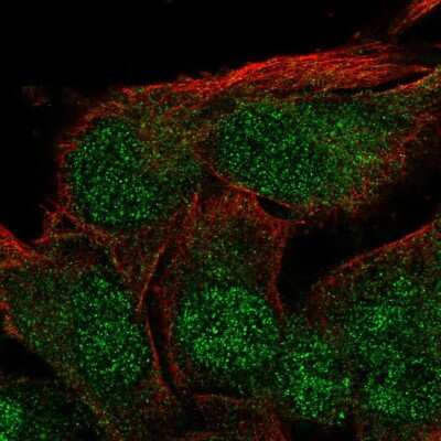 Immunocytochemistry/ Immunofluorescence: ZFYVE27 Antibody [NBP2-56872]