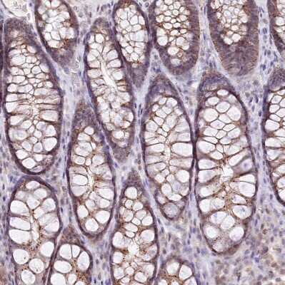 Immunohistochemistry-Paraffin: ZFYVE27 Antibody [NBP1-83512]