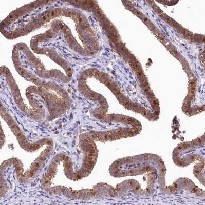 Immunohistochemistry-Paraffin: ZFYVE27 Antibody [NBP1-83512]