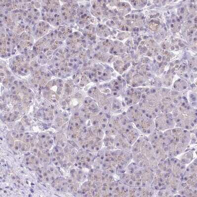 Immunohistochemistry-Paraffin: ZFYVE27 Antibody [NBP1-83512]