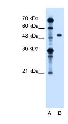 Western Blot: ZFYVE27 Antibody [NBP1-59420]