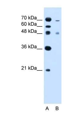 Western Blot: ZFYVE27 Antibody [NBP1-59421]