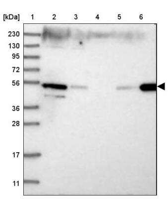 Western Blot: ZFYVE27 Antibody [NBP1-83512]