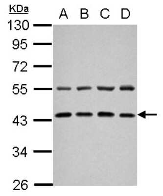 Western Blot: ZFYVE27 Antibody [NBP2-20953]