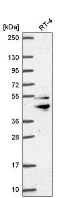 Western Blot: ZFYVE27 Antibody [NBP2-56872]