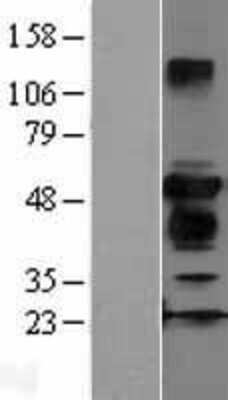 Western Blot: ZFYVE27 Overexpression Lysate [NBL1-18028]