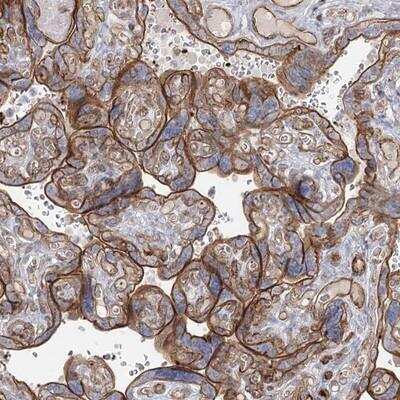 Immunohistochemistry-Paraffin: ZFYVE28 Antibody [NBP1-81390]