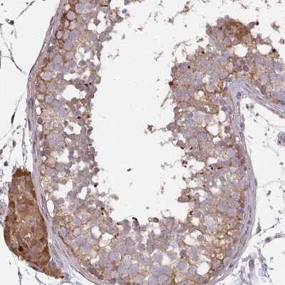 Immunohistochemistry-Paraffin: ZFYVE28 Antibody [NBP2-49262]