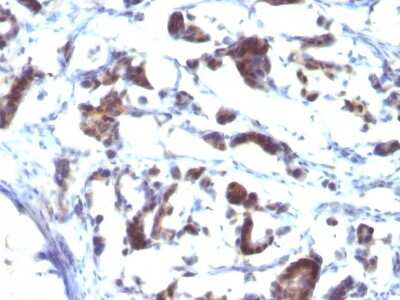 Immunohistochemistry-Paraffin: ZFYVE28 Antibody (LST2/2426) [NBP3-07157]