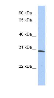 Western Blot: ZFYVE28 Antibody [NBP1-79390]