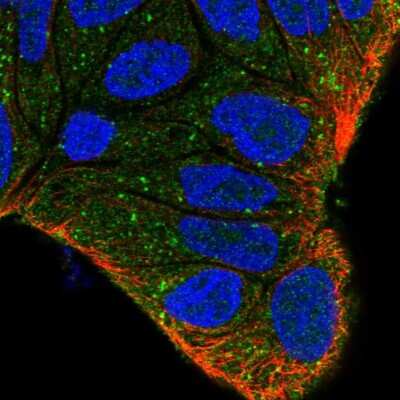 Immunocytochemistry/ Immunofluorescence: ZFYVE9 Antibody [NBP2-57521]