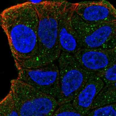 Immunocytochemistry/ Immunofluorescence: ZFYVE9 Antibody [NBP2-57583]