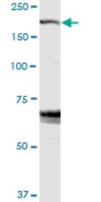 Western Blot: ZFYVE9 Antibody [H00009372-D01P]