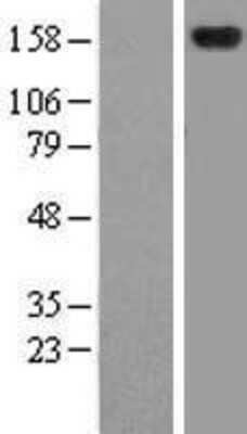 Western Blot: ZFYVE9 Overexpression Lysate [NBL1-18029]