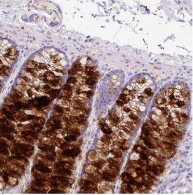 Immunohistochemistry-Paraffin: ZG16 Antibody [NBP2-30568]