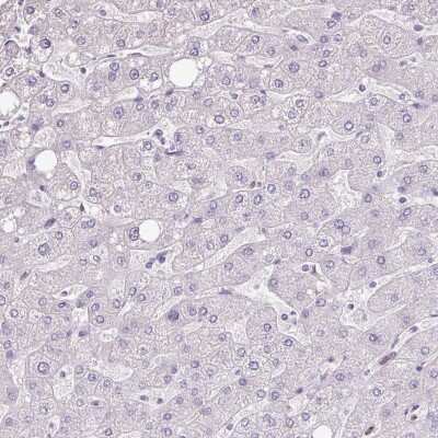Immunohistochemistry-Paraffin: ZG16 Antibody [NBP2-30568]
