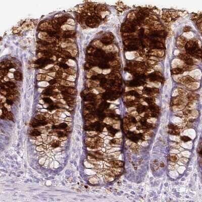 Immunohistochemistry-Paraffin: ZG16 Antibody [NBP2-30568]