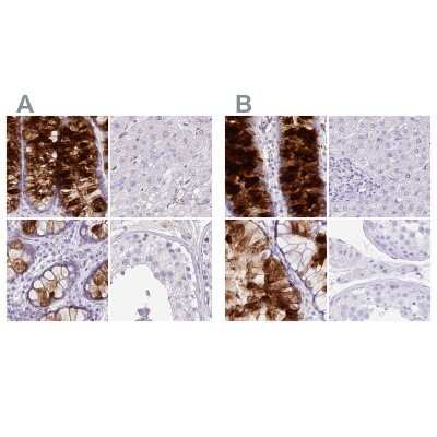 Immunohistochemistry-Paraffin: ZG16 Antibody [NBP2-30568]