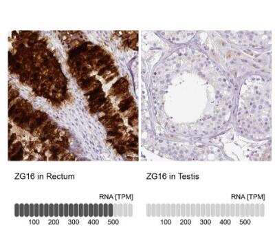 Immunohistochemistry-Paraffin: ZG16 Antibody [NBP2-30568]