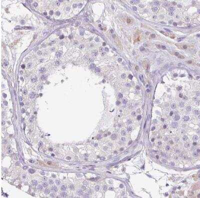 Immunohistochemistry-Paraffin: ZG16 Antibody [NBP2-30568]