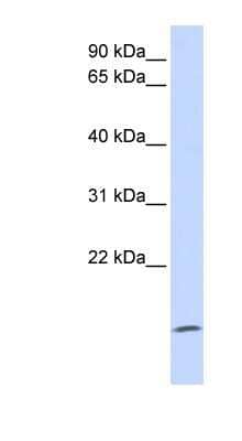 Western Blot: ZG16 Antibody [NBP1-58007]