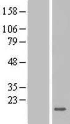 Western Blot: ZG16 Overexpression Lysate [NBL1-18030]