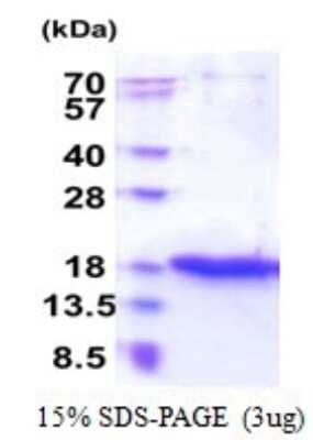 SDS-PAGE: Recombinant Human ZG16 His Protein [NBP2-51632]