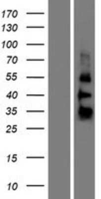 Western Blot: ZGLP1 Overexpression Lysate [NBP2-09349]