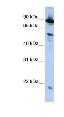 Western Blot: ZGPAT Antibody [NBP1-56561]