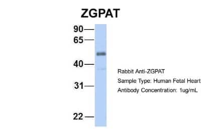 Western Blot: ZGPAT Antibody [NBP1-56562]