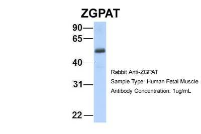 Western Blot: ZGPAT Antibody [NBP1-56562]