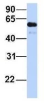 Western Blot: ZGPAT Antibody [NBP1-56937]