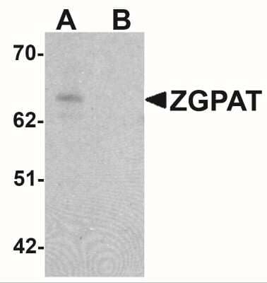 Western Blot: ZGPAT AntibodyBSA Free [NBP2-41146]