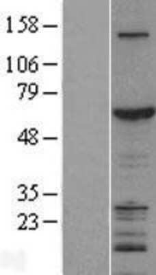 Western Blot: ZGPAT Overexpression Lysate [NBL1-18031]